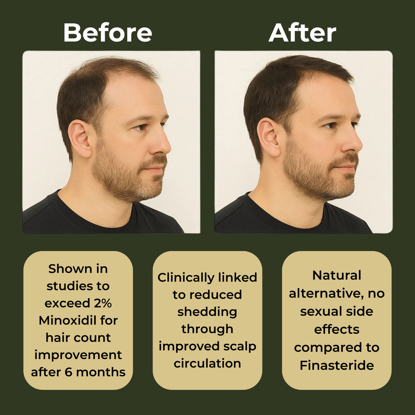 FRAME™ Full Regrowth Routine Kit