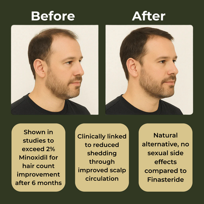 Max-Strength Hair Growth Conditioner